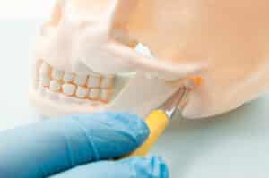 Temporomandibular,Joint,(tmj,,Joint,Of,The,Lower,Jaw),And,The