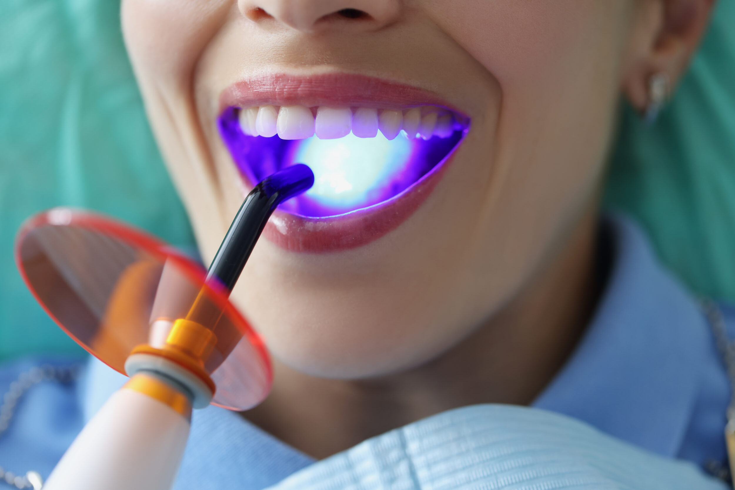 Laser Dentistry Lakewood CO