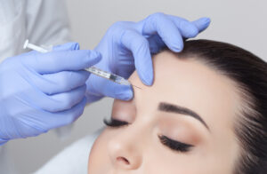 Botox injection performed in between the eyebrows to reduce vertical frown lines.