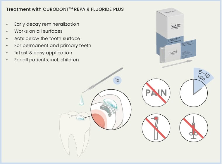 Curodont 1 Curodont: Non-Invasive Remineralization