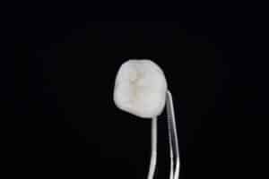 A dental crown is held up with a tool.